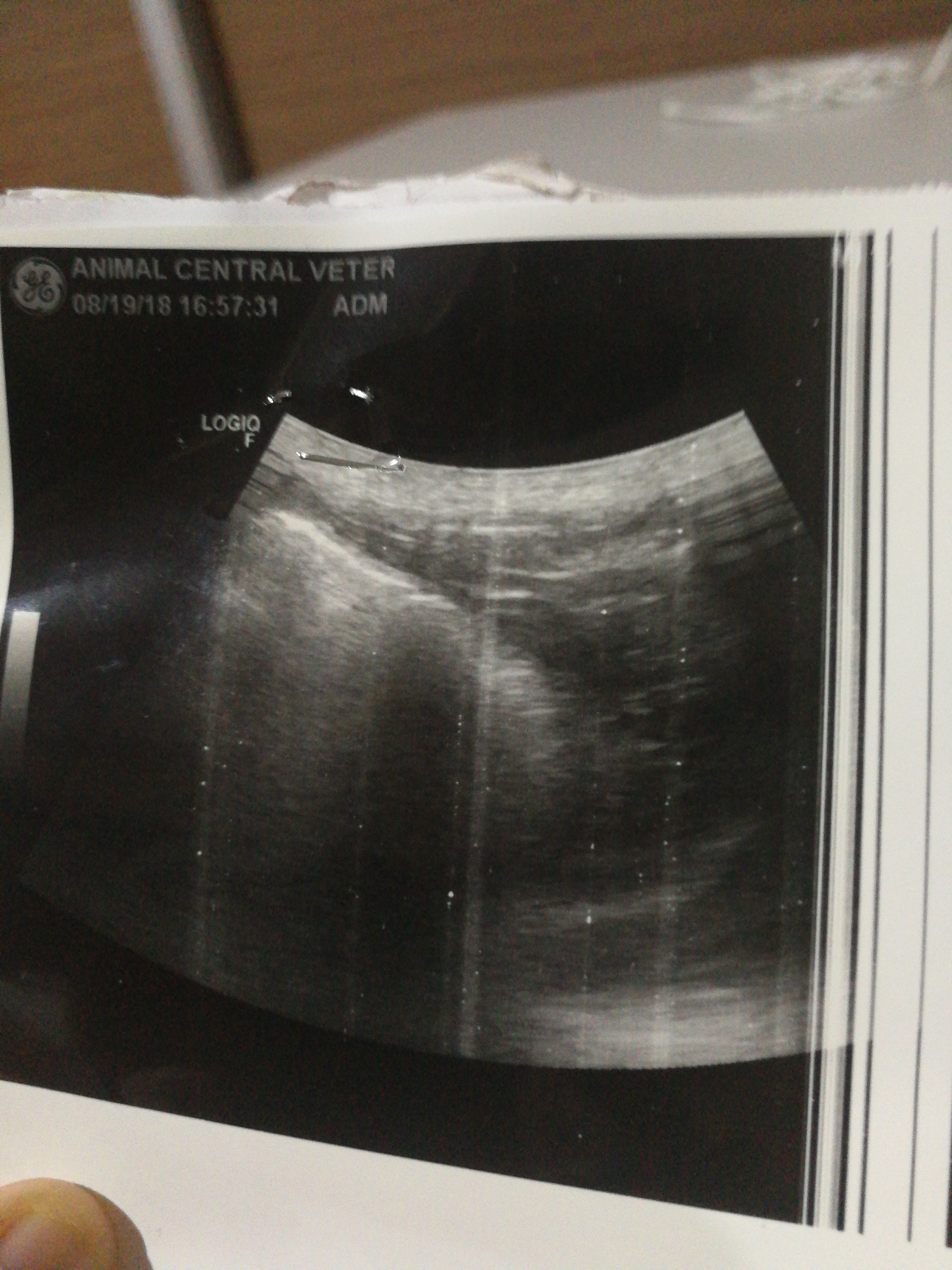An ultrasound of gassy stomach
