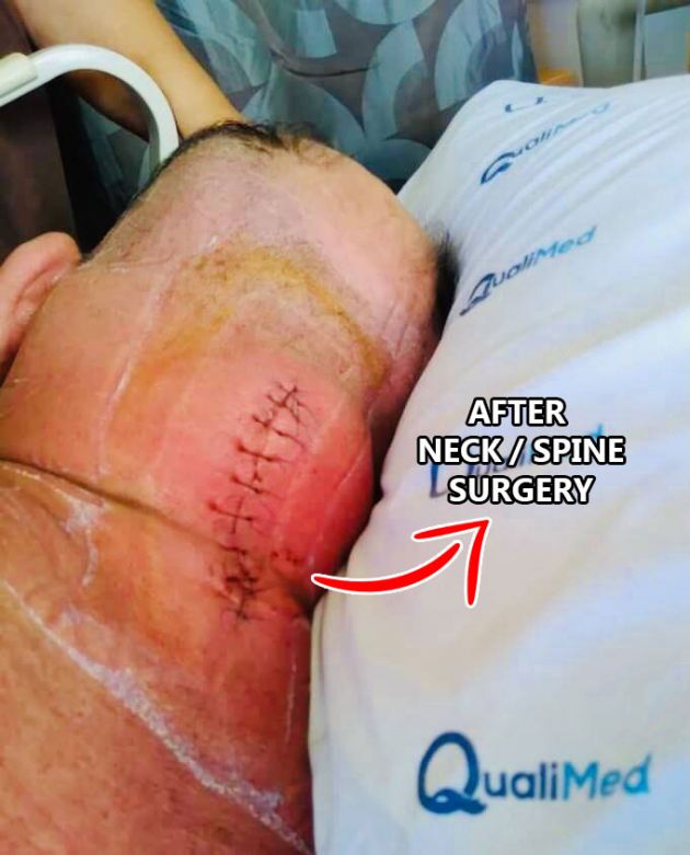 Neck Surgery Incision 
